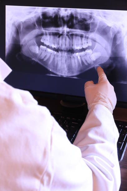 Best Emergency Wisdom Teeth Removal in East Griffin, GA