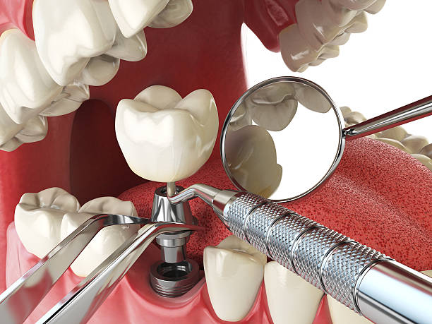 Best Same-Day Emergency Dental Services in East Griffin, GA
